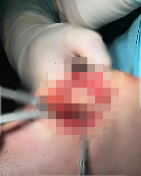 doc-content image
