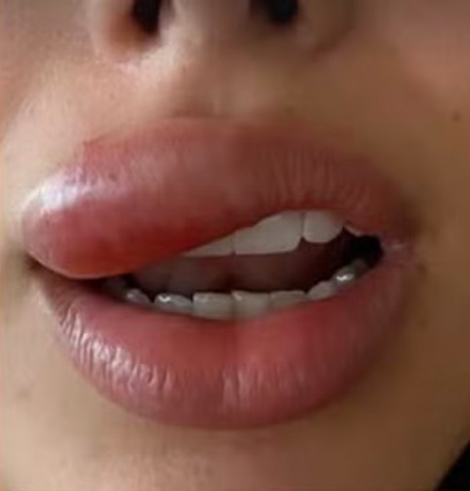 doc-content image